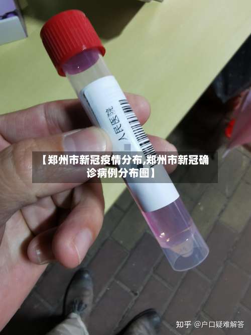 【郑州市新冠疫情分布,郑州市新冠确诊病例分布图】-第2张图片