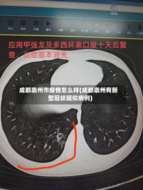 成都崇州市疫情怎么样(成都崇州有新型冠状疑似病例)-第1张图片
